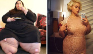 Obezite Hastası Kadın, Erkek Arkadaşıyla Aynı Yatağa Girmek İçin 192 Kilo Verdi!