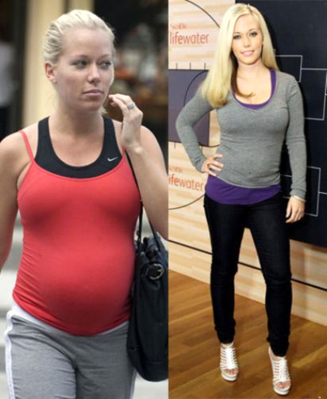 Похудела после беременности. Кендра Уилкинсон после родов. До и после беременности. Похудение после родов. Звезды до и после беременности.
