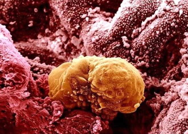 15. Sar Renkli Grnt: 6 gnlk insan embriyosu rahim duvarnda.