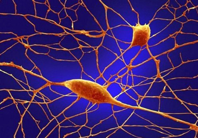 5. Purkinje Sinir Hcreleri: Beyindeki 100 milyar sinir hcrelerinden olan purkinje sinir hcreleri dier sinir hcrelerine gre daha byk boyutlarda. Beynimizde motor grevini gren en nemli yaptamz. Alkol ve lityum gibi toksikler bu sinir hcrelerini negatif ynde etkiliyorlar.