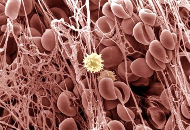 8. Kan Phts: En bataki salkl krmz kan hcrelerinin aksine burada yapkan bir a tarafndan evrelenen krmz kan hcrelerini gryorsunuz. Ortada iek gibi duran hcre ise beyaz kan hcresi.