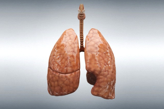 Akcier kanserinin en nemli nedeni sigara imek gibi grnse de, hastalk sigara imeyenlerde de kendisini gsterebilmektedir.