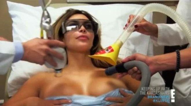 yle ki Kim Kardashian, programnn son yaynlanan blmnde gs blgesinde yaad atlak sorununu gidermek iin lazer tedavisi yaptrd.
