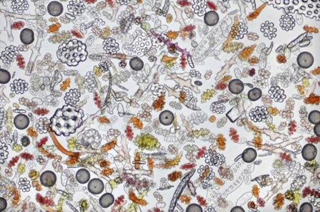 Bu gne kadar mikroskopla ekilen en iyi fotoraflar yaynland. te onlardan bazlar: Deniz kumu
