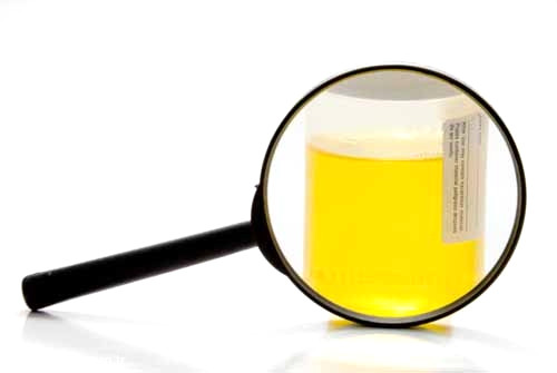 Bu alternatif tedavi y�ntemini �nerenler, idrar�n insan v�cudunu kanserden AIDS