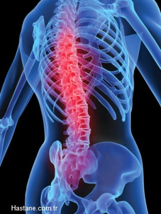 Osteoartrit: H�k�met, bu hastal���n tedavisine yakla��k 48 milyar dolar harc�yor. Y�ll�k artan harcama oran� y�zde 8. Kambur bel �izgisi artritlerin ni�in maliyetinin artt���n�n bir sebebi olabilir. Obezite de artritler i�in b�y�k bir risk fakt�r�. Vioxx ve Celebrex gibi pahal� ila�lar�n ise 2000 y�llar�nda tedaviye eklenmesiyle masraflar daha da artt�. Vioxx isimli ila�, 2004 y�l�nda kalp krizi riskini art�rd���na dair ba�lant� ortaya ��k�nca piyasadan toplat�ld�. Pfizer taraf�ndan sat�lan Celebrex ise toplat�lan ila� kadar pop�ler de�il.