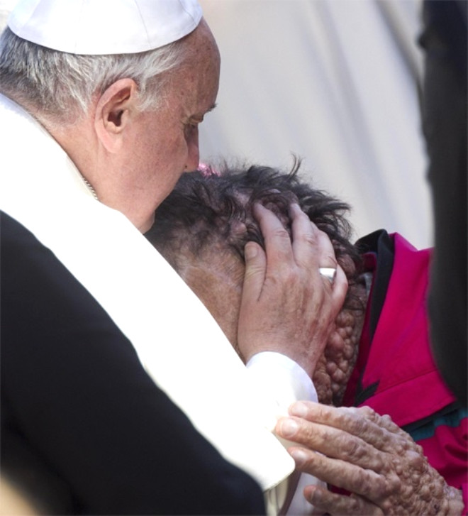 Papa Francis, genetik bir hastal olan Vinicio Riva