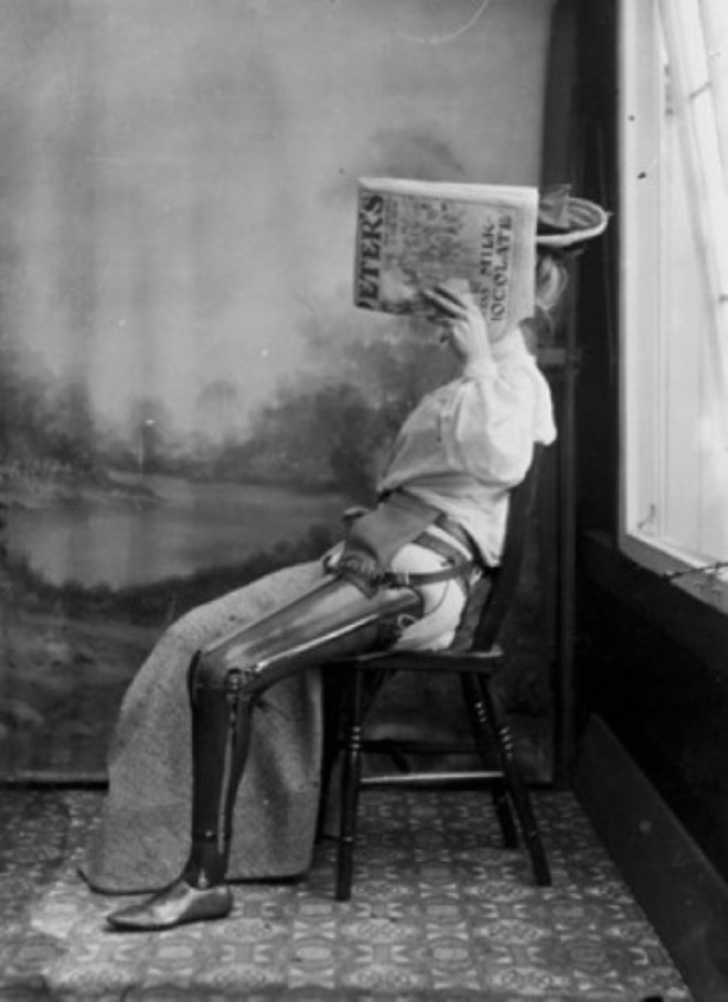 1890-1900 yllar aras ekildii sanlan bu fotorafta bacan kaybeden bir kadna taklan tahta protezi gryoruz..