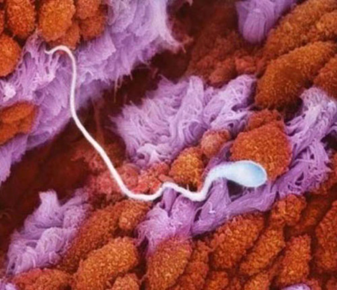 Sperm hcresi Fallop tplerinde yumurtaya doru ilerliyor.

