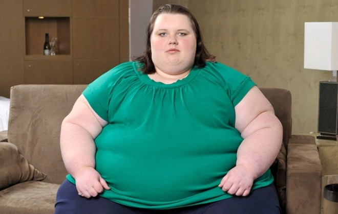 Obezite bugn bal bana bir salk sorunu. Obezite