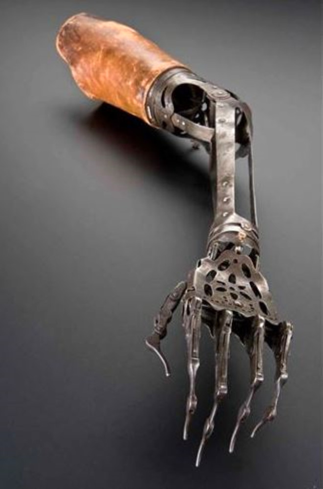 1850 - 1910 yllar arasnda kullanlan protez sol kol.
