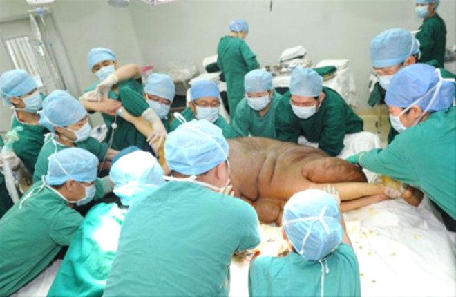 110 kiloluk tmr uzun cerrahi operasyon sonucunda karld.
