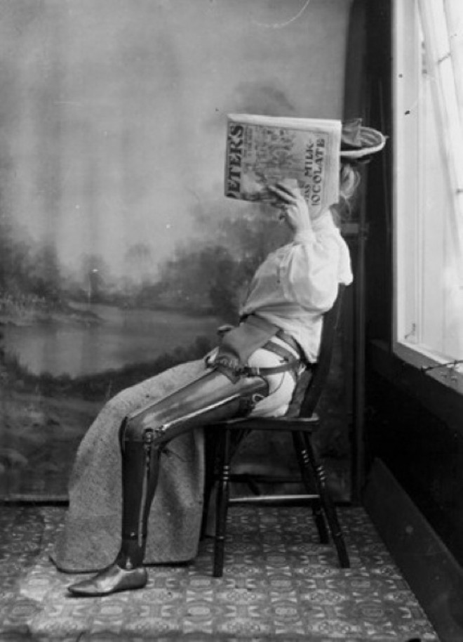 1890-1900 yllar aras ekildii sanlan bu fotorafta bacan kaybeden bir kadna taklan tahta protezi gryoruz.
