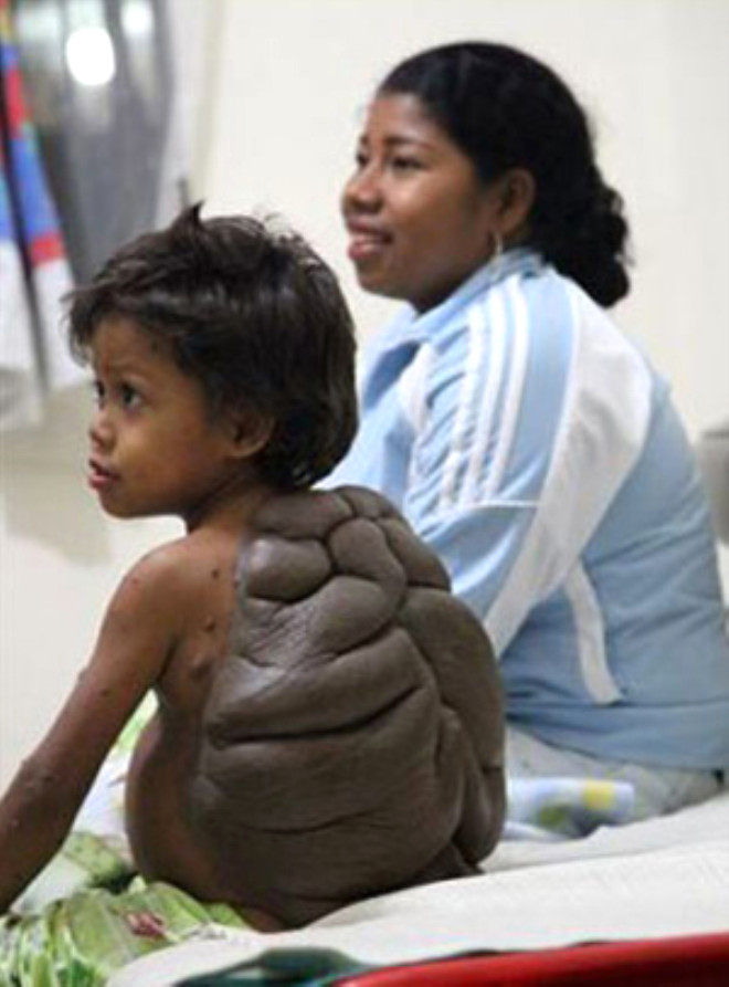 Bir dier artc hastalk ise, 8 yandaki Didier Montalvo hayatnda ilk kez byk bir olay iin Kolombiya
