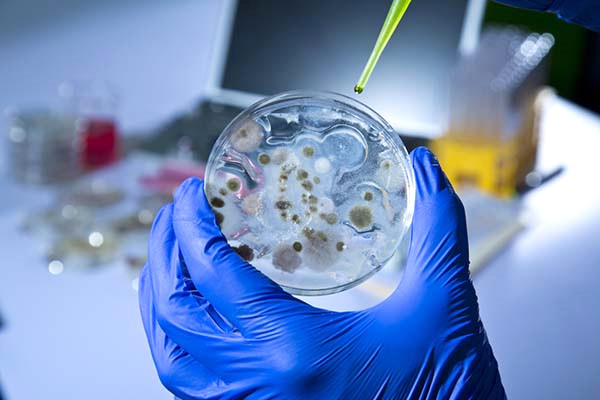 Ebola vir�s� ta��yan ancak iyile�me s�recinde olan bir ki�inin spermlerinde en az 70 g�n ve hatta baz� �al��malara g�re 90 g�n aktif kalabildi�i belirtilen a��klamada, t�k�r�k ve g�zya��n�n da d���k de olsa vir�s ta��d��� kaydedildi.
