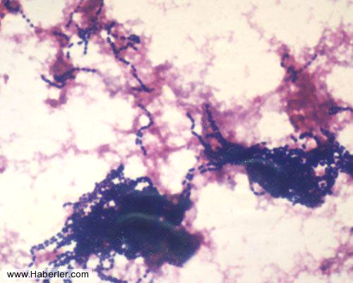 Di�lerde bulunan Streptococcus sangius ve S.mutans bakterileri. B�l�nd�kten sonra ayr�lmay�p, zincir formunda kalan yuvarlak bakterilerdir. E�er di�lerinizi d�zenli olarak f�r�alamazsan�z di� y�zeyinize tutunmu� 300-500 aras� bakteri tabakas�na sahip olursunuz. Bu di� pla��n�n ba�l�ca t�r� 