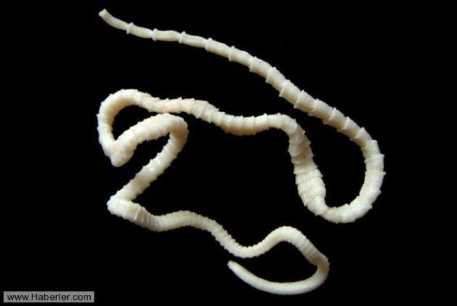Barsak solucan. Ascarididae familyasnn bir yesidir. Omurgasz olan bu canl, ince barsaa yerleerek enfeksiyona neden olur. Karn ars, ishal ve kusma yapar. lala tedavi edilir. Asalak olarak yaar ve silindirik yapdadr. 35 cm uzunlua ulaabilir. Larvalar, kirli sular ve yiyeceklerle barsaa yerleir. Larvalar, akciere ularsa, akcier iltihabna yol aar.

