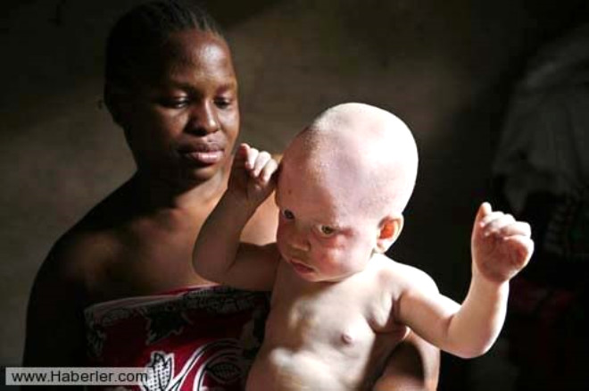 Emniyet kaynaklarndan alnan bilgiye gre, lkenin kuzeydeki Geita eyaletine bal Chato kentinde pazar gn annesinin yanndan karlan bir yandaki albinolu Yohanna Bahati