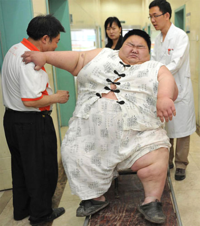 Bugne kadar kilo verebilmek iin birok ynteme bavuran ancak baarl olamayan Yong, 1 haftadr hastanenin youn bakm nitesinde tedavi grm hemire ve doktorlar kilosundan dolay Yang