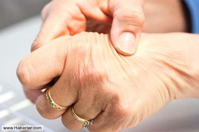 Romatoid artrit (ltihapl romatizma): El ve ayaklardaki kk eklemlerin iinde ar ve imeye yol aan bu iltihabi hastalk bazen ciltte de kendini gsterebilir. Bu hastalarn yaklak yzde 20 ile 30