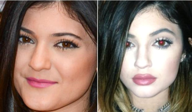 Kim Kardashian n vey kardeive ayn zaman Kardashian kardelerin en k olan Kylie Jenner gibi dolgun dudaklara sahip olmak isteyen genler dudaklar iin farkl yntemler denemeye baladlar. Sonu, ince dudaklarn hibir zarar olmadn anladlar. Kylie Jenner, 19 ay nce byle grnyordu. 
