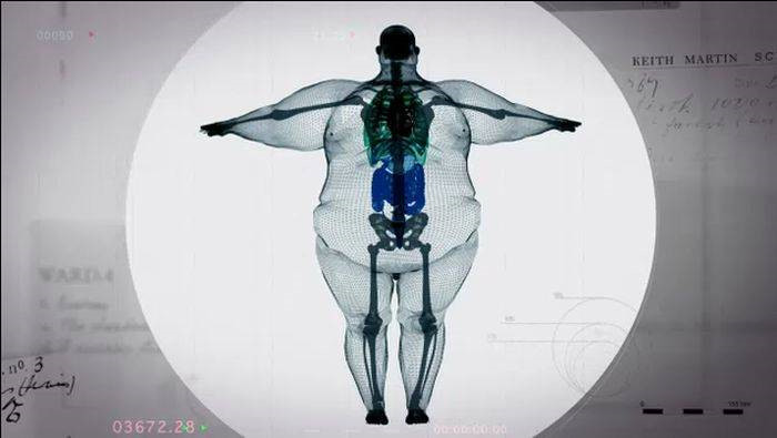 �skeletinin bu b�y�kl�kteki v�cudu ta��mas� ise imkans�z g�z�k�yor.
