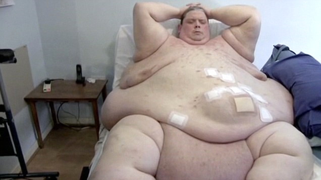 Tam 445 kiloyla inan�lmas� g�� bir rekoru elinde bulunduran Keith Martin, bundan 8 ay �nce mide ameliyat� olmu� ve a��rl���n�n neredeyse 3/4
