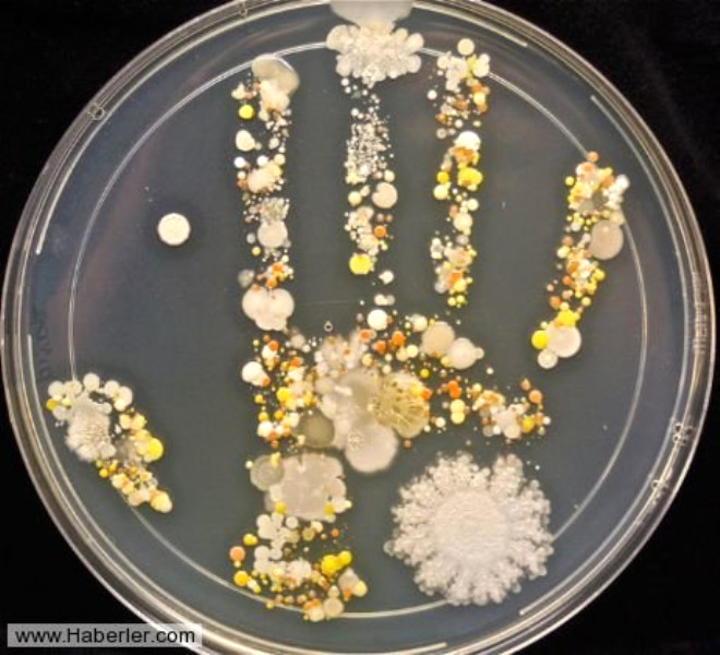 California Cabrillo Koleji labratuvar teknisyeni olan,Tasha Sturm 8 yasndaki olunun darda oynadktan sonar elinde bulunan bakteri, mantarlar grntledi.

Olaanst grntler, cildimizde yaayan mikroplarn farkl dnyasn gsteriyor.
