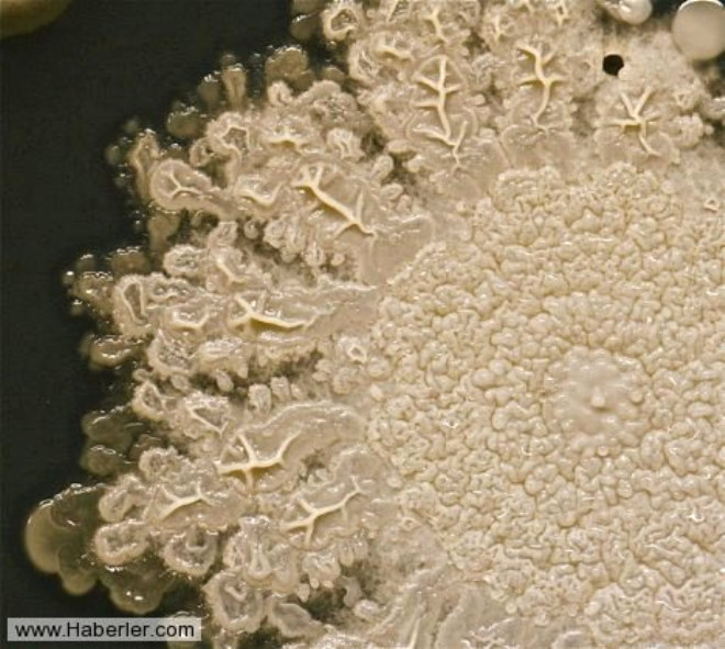 Bu sreci Microbe World (Mikrop Dnyas) sitesinde yaynlayan Sturm, standart mkrobiyolojik analizlerde genel kat beiyeri olarak kullanlan trypyische soya- aar jlesi sayesinde mkemmel grntler elde etti.
