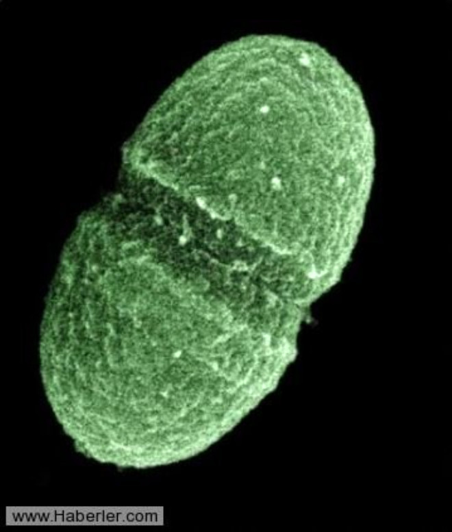 Mikroplara da mikrop bular m?

Evet. Mikroplara da bulaan daha kk mikroplar bulunuyor.
