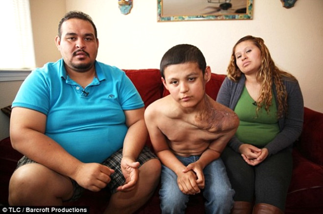 Ciudad Juarez kentinde yaayan 11 yandaki Hose Antonyo Ramires, boynunda kk bir ur parasyla dodu. Yllar getike boynundaki ur paras byyen Hose Antonyo