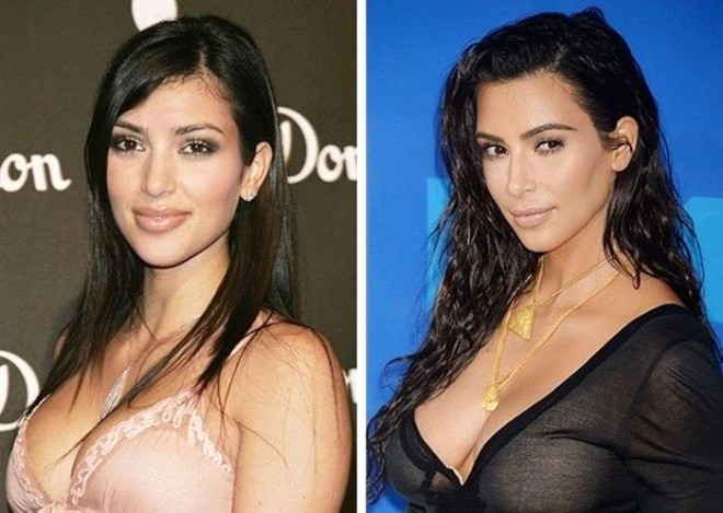 Kim Kardashian, vcudu ve giydii kyafetlerle tannd. 35 yandaki reality ov yldznn estetik dokunularla da grnmnde deiiklik yapt biliniyor.
