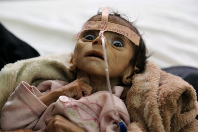 Yllardr sren i atmalara sahne olan Yemen