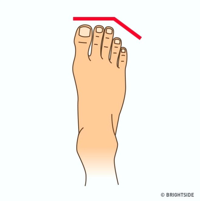 En yaygn olan. Bu ayaklar olan insanlar genelde dosta davranr. Antik an karizmatik halk figrlerinde byle bir ayak formuna rastlanmtr.
