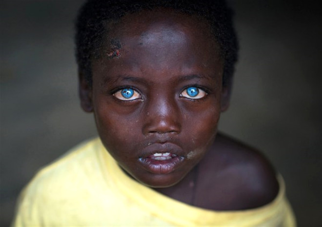 Gney Etiyopyal Abushe, siyah bedeni ve mavi gzleriyle dikkat ekiyor.
