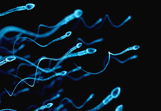 

 

 

Dk sperm says,

 

Yava hareket eden spermler (kadnn yumurtasna ulaamadan lrler),

 

Olumasnda sorun olan spermler.

 


