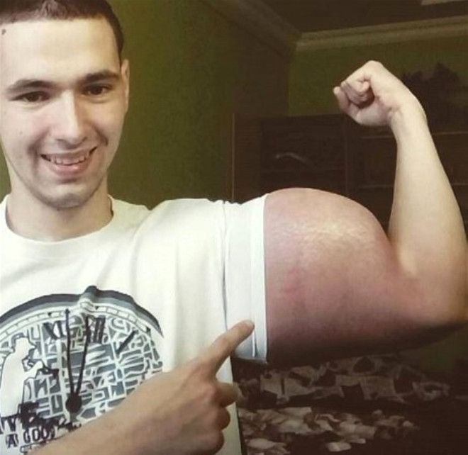 lgin kol kaslaryla nlenen 21 yandaki Kirill Tereshin