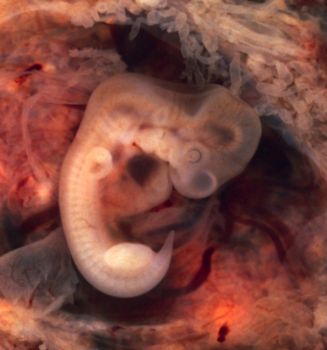 Bilim insanlar ilk kez insan embriyosunun genlerini deitirerek bebein bydnde geirmesi muhtemel olan lmcl hastalklar engelledi.
