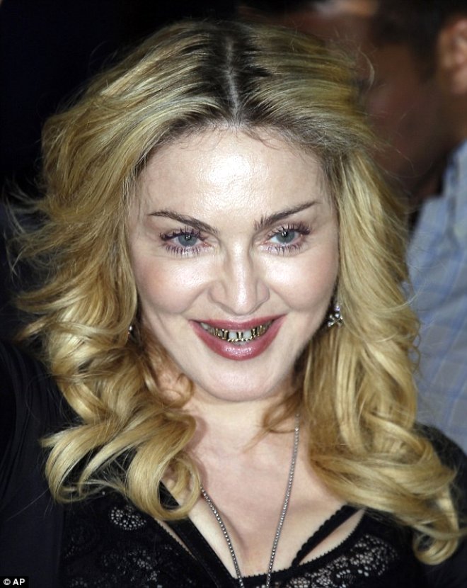 60 yandaki dnyaca nl arkc Madonna, 2014 ylnda katld bir davete altn dileriyle gelerek, kyafetiyle uyumlu olduunu sylemiti.