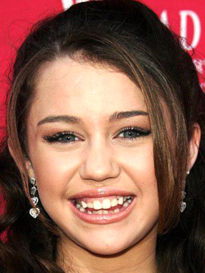 Amerikal oyuncu ve arkc Miley Cruise, dilerini dzelttirerek, bambaka bir grnt kazand.