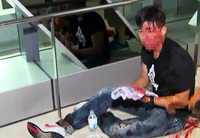 Hong Kong polisi de baz kiilerin Yuen Long istasyonu platformlarnda saldrya uradklarn ve bunun sonucunda yaralananlar olduunu aktard. 