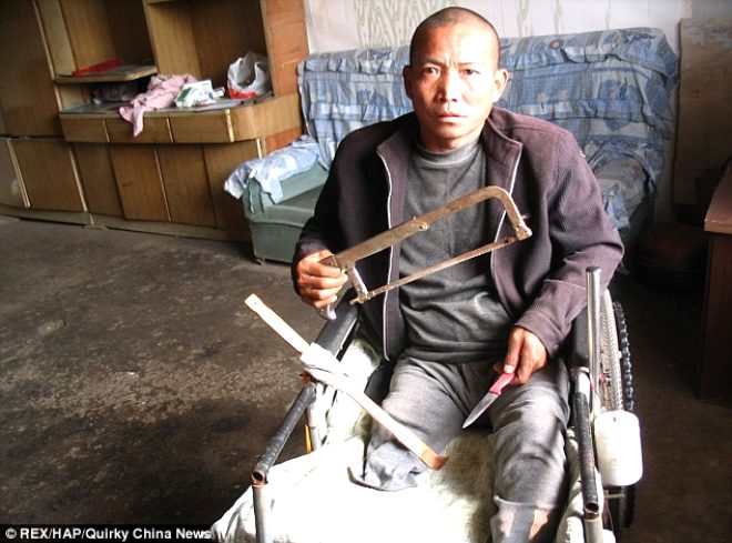 inli ifti Zheng Yanliang, 2002 ylnda, sa bacandaki rahatszlk nedeniyle hastaneye bavurdu ancak hastane kendisinden, ameliyat olmas 1 milyon yuan istedi.