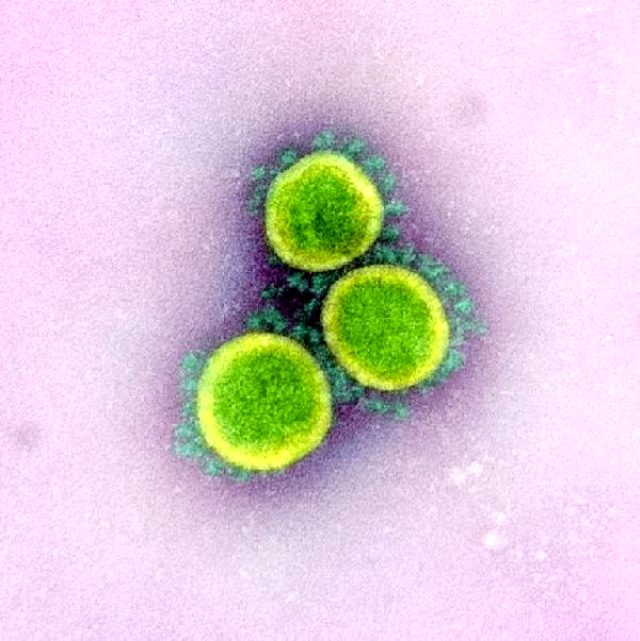 Koronavirüsün vücuda nasıl yayıldığı ilk kez görüntülendi