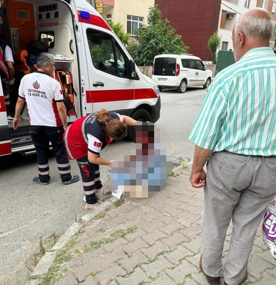İstanbul'da köpek saldırısına uğrayan kadın gözünü kaybetti