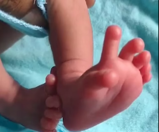 Hindistan'da Bharatpur şehrinde 26 parmakla dünyaya gelen bebek tanrıça olarak görülüyor